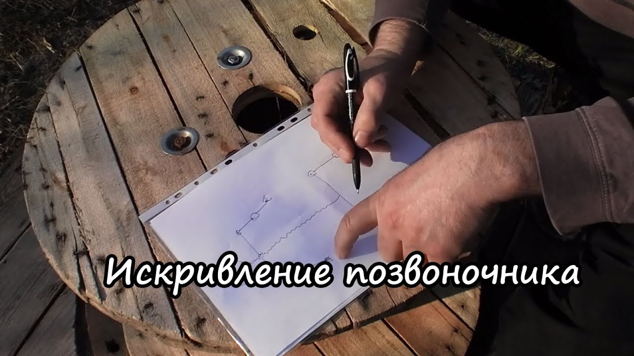 Искривление позвоночника, кривые плечи, кривая осанка как исправить ...