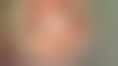 Ossiculoplasty with TORP Malleus relocation & Silastic Banding Dr Robert Vincent