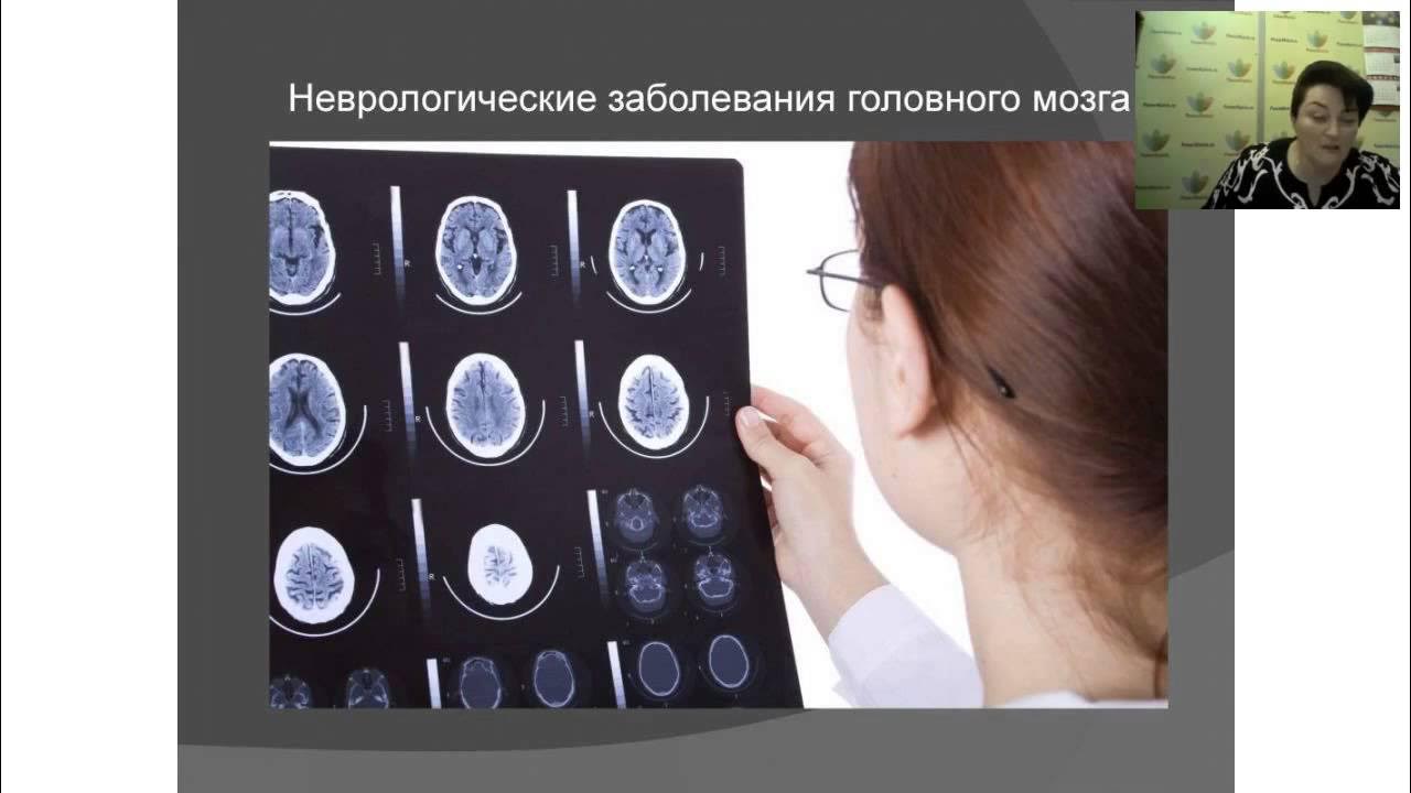 Лекарство неврология. 125мг №50. Неврологические заболевания у детей список. Циннаризин. Периферическим анальгетическим действием обладают.