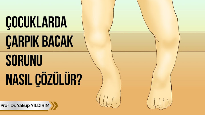 Çocuklarda Ayak Sağlığı ve Ayak Problemleri | Prof. Dr. Yakup YILDIRIM