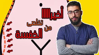 الحل الطبى النهائى للتخلص من الخفسة (دايت وتمرينات و.. )hip dips