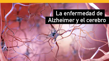 ¿Qué sustancias químicas pueden causar Alzheimer?