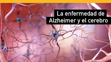 ¿Qué parte del cerebro deja de funcionar con el Alzheimer?