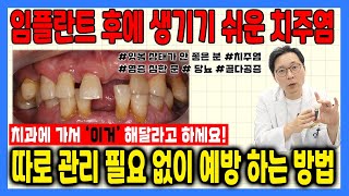따로 관리 할 필요 없이 치과에서 한 번만 하면 평생 끝!!!  l 잇몸 염증, 치주염 등 미리 예방하는 방법 l