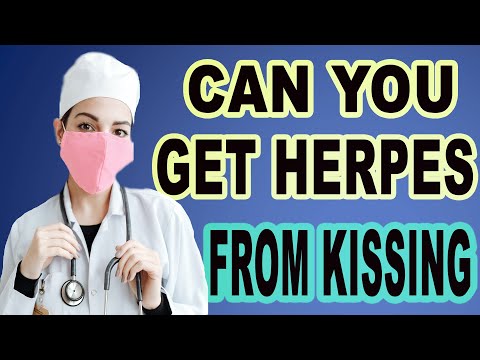 Can You Get Herpes From Kissing