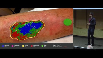 HL7 FHIR Applications Roundtable December 2017: Joshua Budman-Advanced Wound Documentation