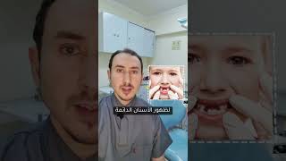 الخلع المبكر للأطفال