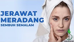 3 Cara Cepat Menghilangkan Jerawat Meradang Dalam 1 Malam - Durasi: 5.07. 