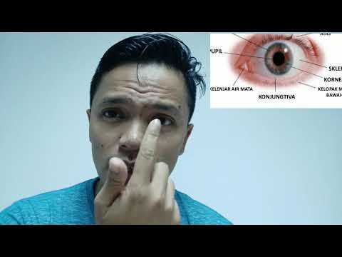 Video: Cara Mengeluarkan Objek Asing dari Mata: 13 Langkah