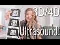 3D Ultrasound Of Our Baby Boy! | Teen Parents