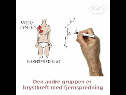 Video: Måling Av Brystkreft: Tips For Identifikasjon