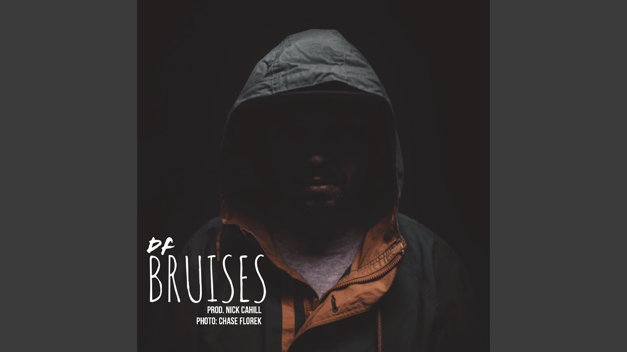 Guarda Bruises su YouTube Guarda Bruises su YouTube
