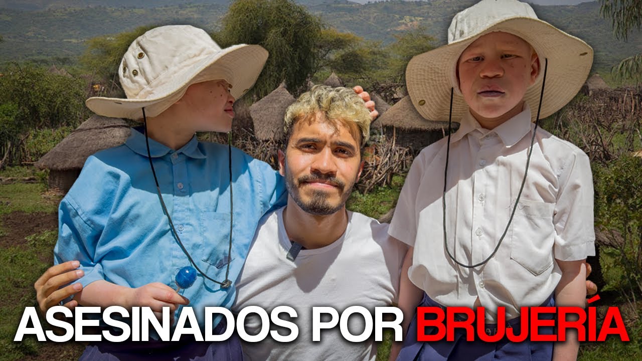 Estos niños están en grave peligro: Albinos en África