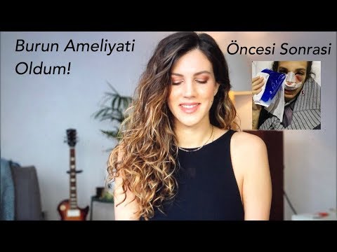 Burun Ameliyatı sürecim | Öncesi- Sonrası ACIYOR MU ?