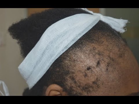 Vidéo: Comment faire pousser les cheveux des filles noires (avec des photos)