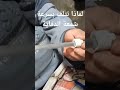 سبب تلف شمع الدفاية بسرعة  الفيديو كامل هنا
