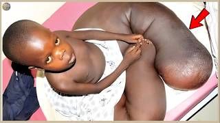 Unbelievable: The boy with "monster legs" and an unsolved medical mystery! – Rare People