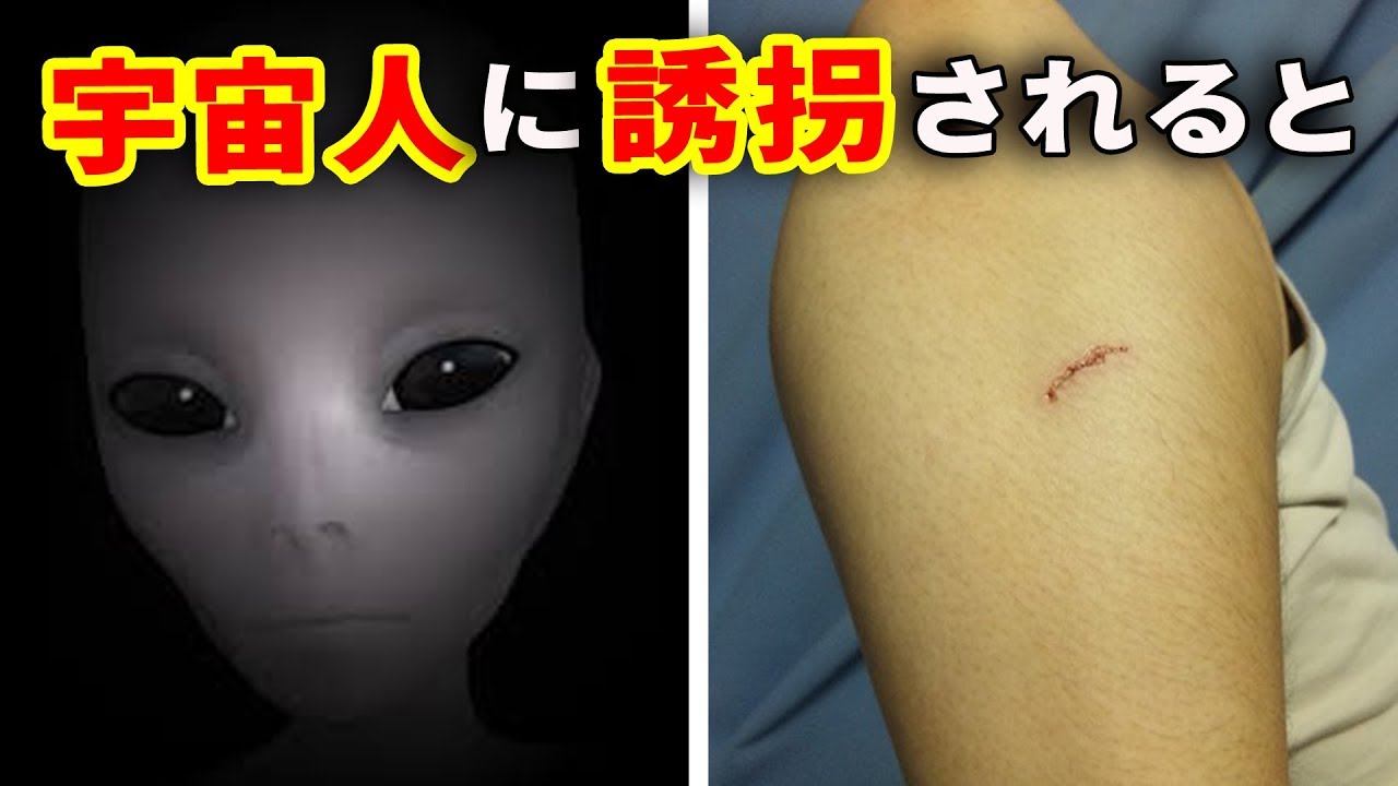 Ufo 宇宙人に誘拐されたかもしれない身体のサイン Youtube