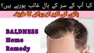 Ganjpan Ka Ilaj Baldness Home Remedy Ganjpan Khatam Karne Ka Tarika Hair Loss Treatment