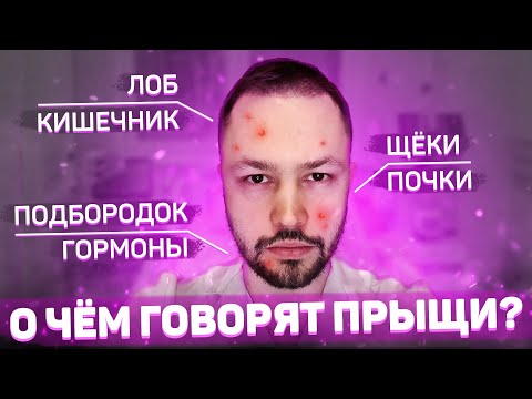 Видео: Что означают прыщи на щеках?