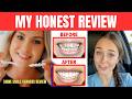 Shiny Smile Veneers (MY HONEST REVIEW) I TRIED SHINY SMILE SNAP ON VENEERS AND THIS IS WHAT HAPPENED