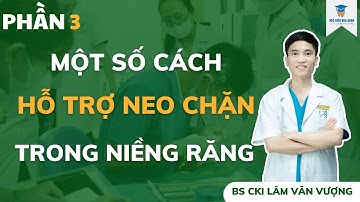 Một Số Cách Hỗ Trợ Neo Chặn Trong Chỉnh Nha P3