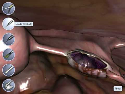 Best penis enlargement on the market