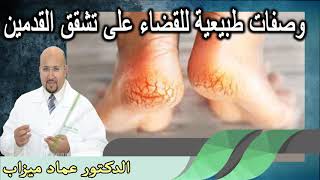 وصفات طبيعية للقضاء على تشقق القدمين الدكتور عماد ميزاب