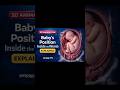 How Babies Position Themselves Before Birth | 3D Medical Animation#fetalpostion #pregnancy