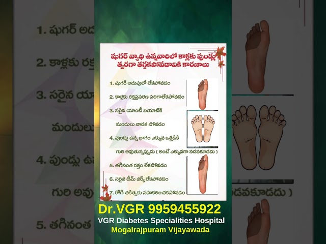 Diabetes | foot care | Health Tips | షుగర్ | Doctor | vgr | vgr hospital