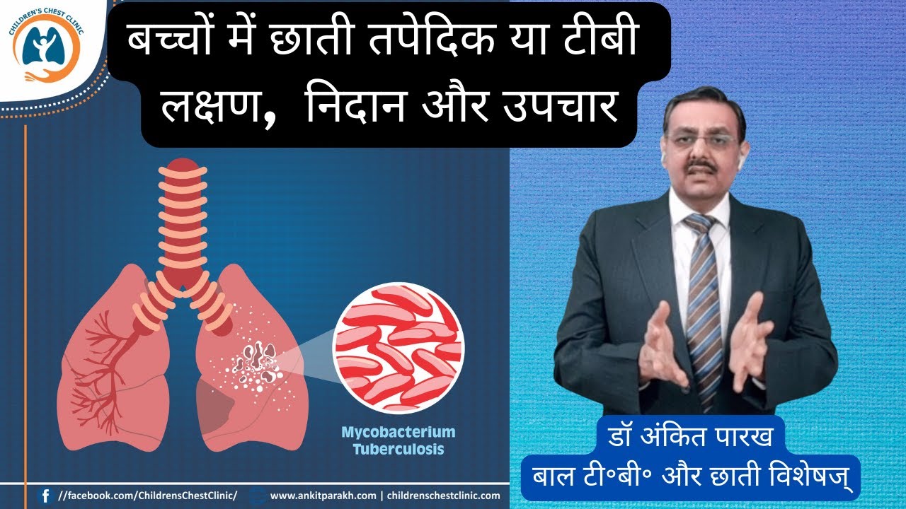 बच्चों में छाती तपेदिक या टीबी: लक्षण, निदान और उपचार:
