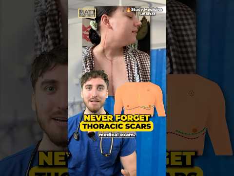 Easily remember THORACIC