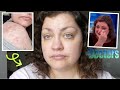 4 Years Later... Being On TV Changed My Life | Dermatillomania Update (Get Ready With Me)