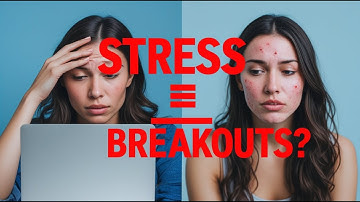 Can Stress Cause Breakouts? The Truth About Anxiety and Acne