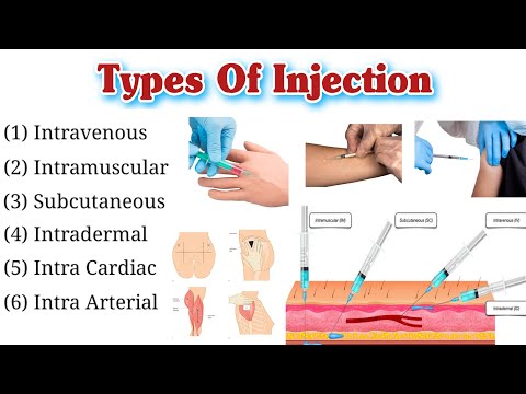 Types Of Injection