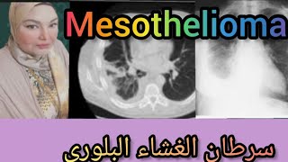 الميزوثيليوما، سرطان الغشاء البلوري ،هام لعمال البناء ورجال المطافئ وغيرهم mesothelioma