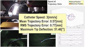 Sikorski et al. - TMech 2019 - Surgical Robotics Lab
