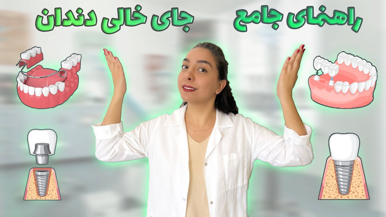 جایگزین دندان از دست رفته:‌مقایسه ایمپلنت، بریج و پروتز دندانی