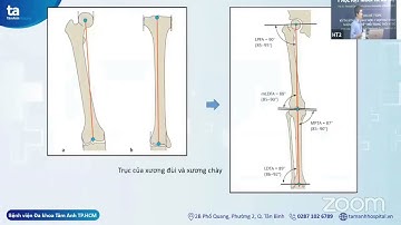 [VART 2022] HT2P2-04 Kỹ thuật chụp XQ toàn bộ cột sống, trục chi dưới ứng dụng trong lâm sàng