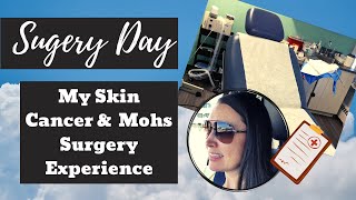 Skin Cancer Mohs Surgery  & What to Expect | My Experience having Mohs Surgery for My Skin Cancer