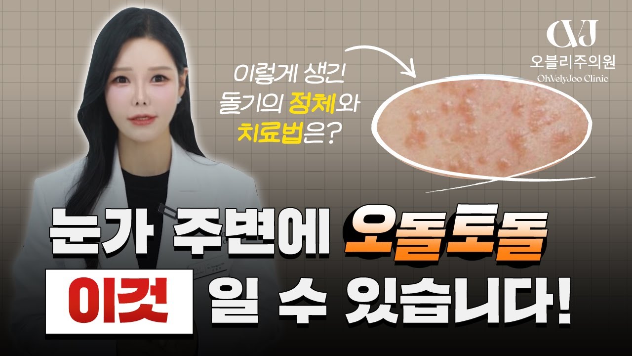 눈가 주변에 오돌토돌 났다면?😮 '이것'일 수 있습니다!