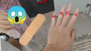 Eylülün Annesinin Eli Dolaba Sıkıştı Eylül Yara Bandı Yapıştırdı | fun kids video