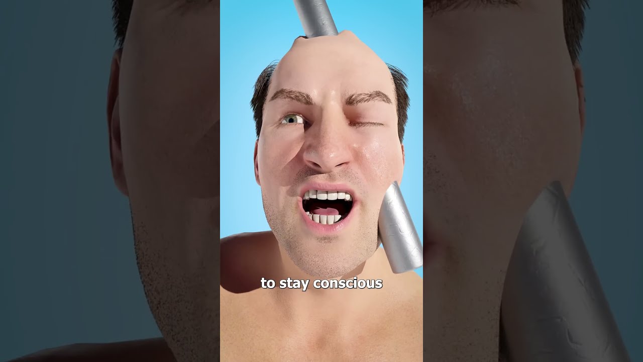 Iron Rod Through The Head 