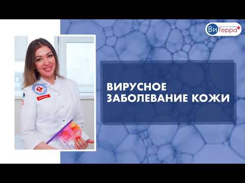 Вирусные заболевание кожи. ВПЧ. Лечение лазером. Сургитрон.