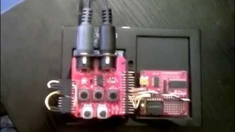 heart rhythm machine