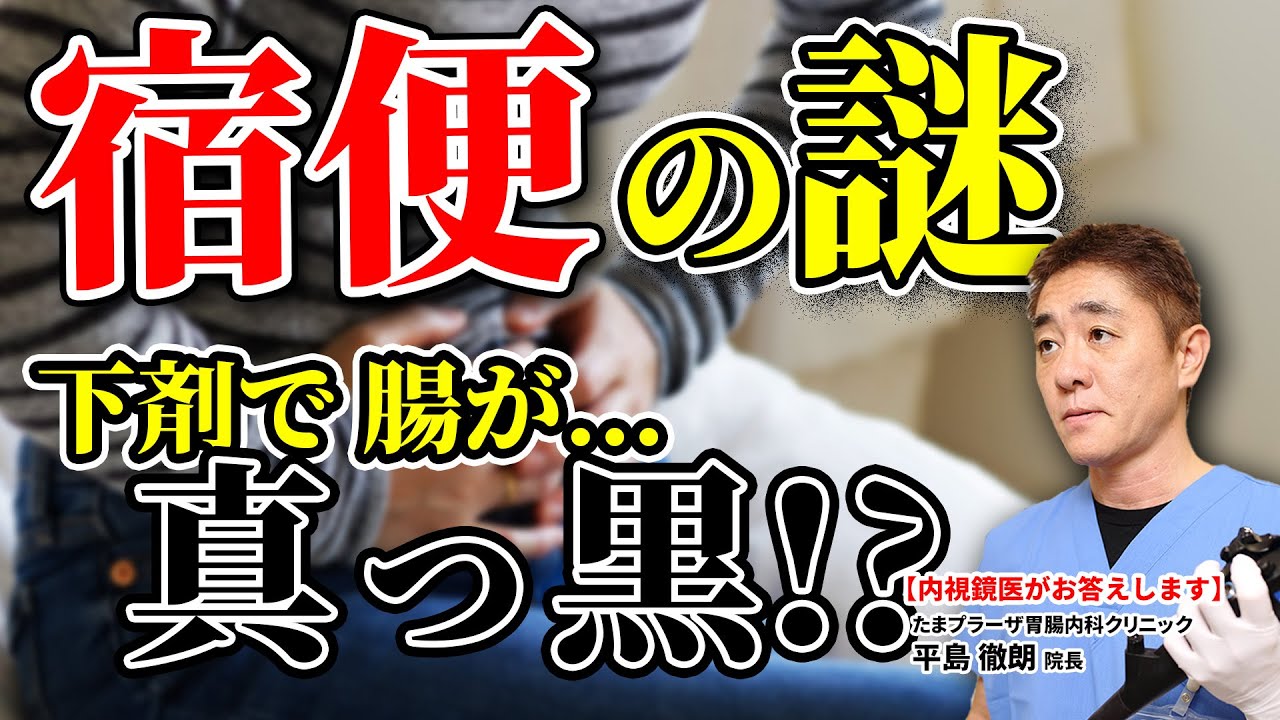 【知らないと絶対に損します!!】広告でよく見る「宿便」って何？　市販の下剤の落とし穴　わかっていない方がほとんど!!　継続使用で大腸が真っ黒!?  胃腸のプロが解説 教えて平島先生  No170