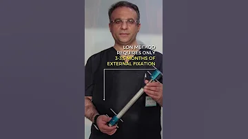 Leg Lengthening Surgery With LON Method Dr Yuksel Yurttas Leglengthening Limblengthening 