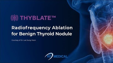 THYBLATE™ Thyroid RFA Tips and Techniques