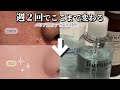 【週2回だけ】で毛穴ここまで変わる。インナードライでもできた夜の毛穴ケア