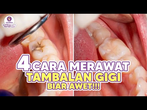 Video: Kapan menggunakan tambalan dingin?